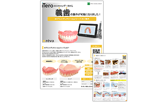 口腔内スキャナー義歯スキャンマニュアル（iTero）