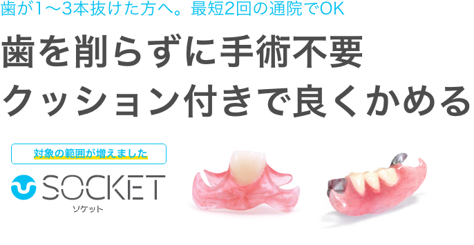 歯が1〜3本抜けた方へ。最短2回の通院でOK。歯を削らずに手術不要。クッション付きで良くかめる